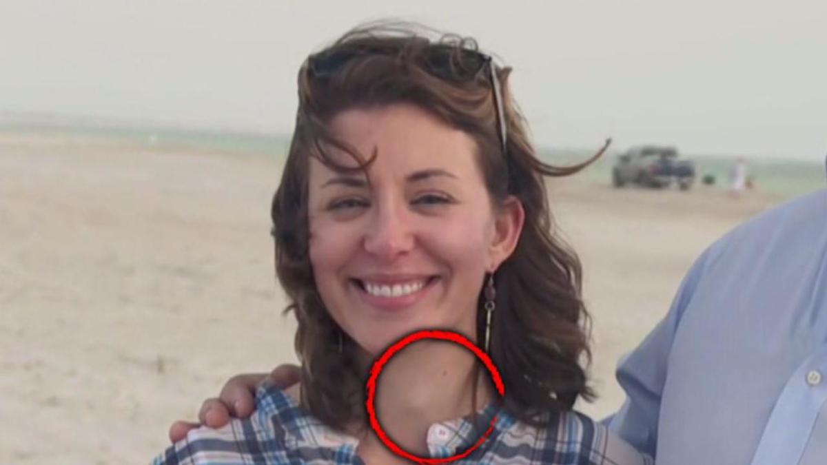 Doctor Saves Womans Life After He Spots This Lump On Her Neck