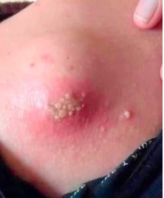 Skin Signals Used to Diagnose Serious Diseases 