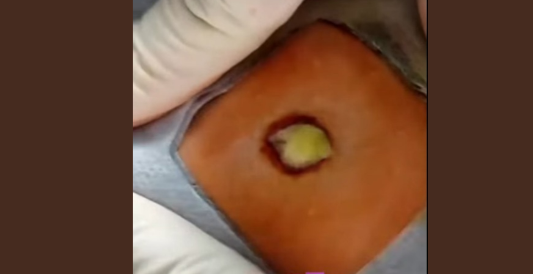 4 Symptoms That May Reveal Health Problem