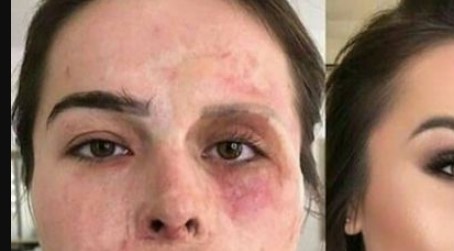 After suffering third degree burns this woman’s transformation is unbelievable